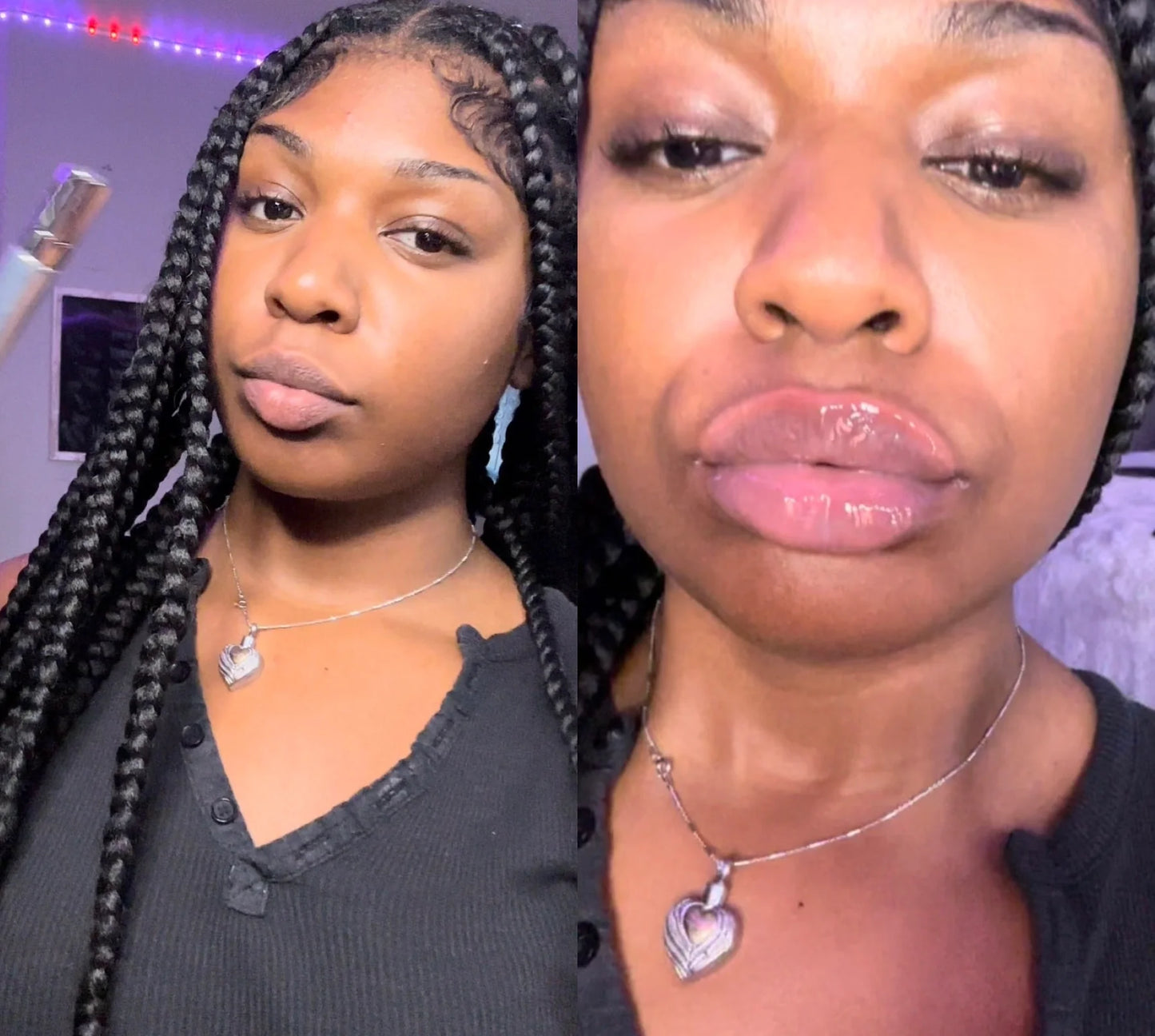 Intense Lip Plumper (Lip Filler)