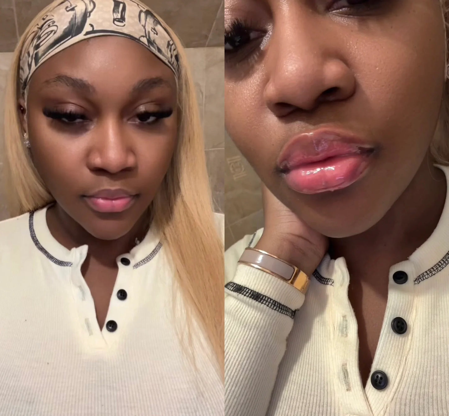 Intense Lip Plumper (Lip Filler)