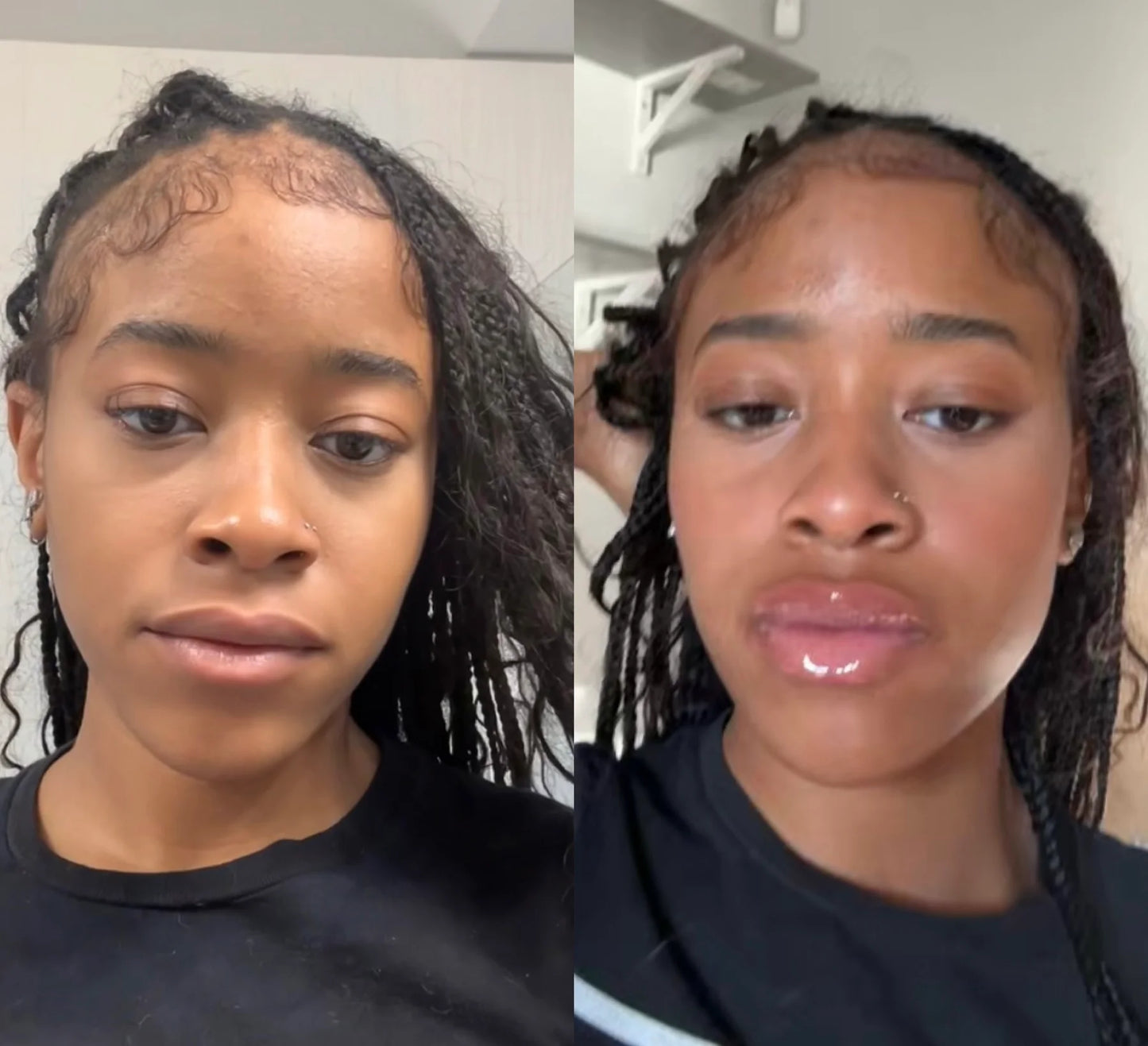Intense Lip Plumper (Lip Filler)